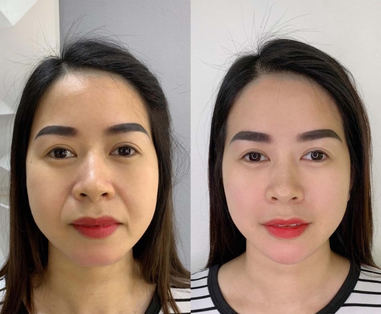 AdsGoogle Việt Nam mang đến giải pháp