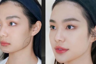 CĂNG CHỈ TRẺ HÓA – DỊCH VỤ TRIỆU ĐÔ NHƯNG KHÔNG AI BIẾT SẾP CÓ!