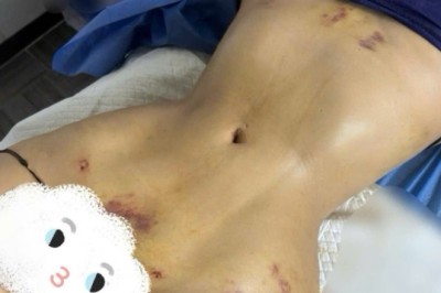 GIẢM BÉO CÔNG NGHỆ CAO – KHÁCH CẦN GIẢI PHÁP, KHÔNG CẦN ƯU ĐÃI!